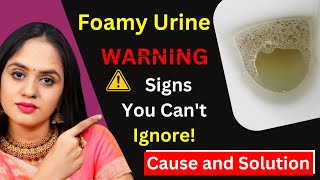 Foamy Urine WARNING Signs You Cant Ignore  Foamy Urine Cause and Solution  Dr Tanvi Mayur Patel [upl. by Marj]