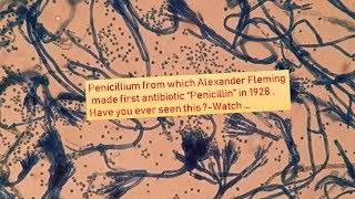 Penicillium under the Microscope [upl. by Aynuat123]