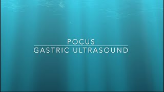 Gastric Ultrasound An Essential GuideGastric ultrasound scan for preoperative assessment [upl. by Irok301]