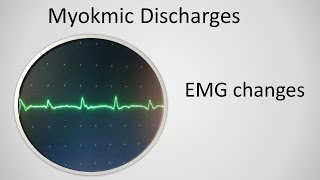 Myokymia on EMG [upl. by Muriel]