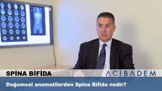 Doğumsal anomalilerden Spina Bifida nedir [upl. by Aital]