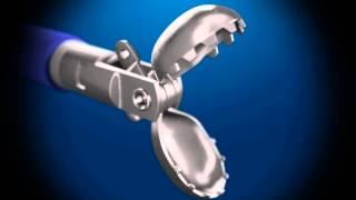 Sample Endoscopic Biopsy 3D animation DG Medical Animations HD [upl. by Rhpotsirhc]