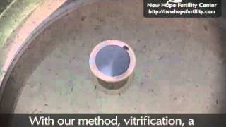 Egg Freezing through Vitrification [upl. by Lasorella848]