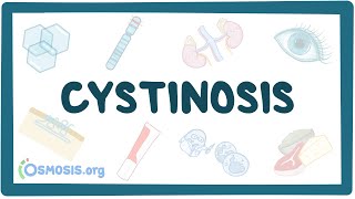 Cystinosis  causes symptoms diagnosis treatment pathology [upl. by Riem148]