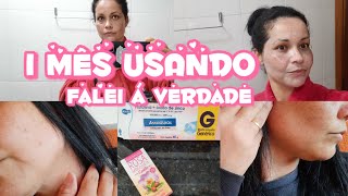 Resultado de 1 mês Usando Nistatina Óleo De Rosa MosquetaPra Clarear Melasma e Manchas De Acne [upl. by Demb]