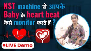 NST Machine से Baby की Heart Beat Monitor कैसे करते है   How to Monitor Babys Heartbeat with NST [upl. by Shivers]