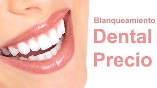 Blanqueamiento Dental Precio [upl. by Annoyek]