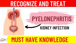 What is Pyelonephritis  All you need to know  Causes  Symptoms  Diagnosis  Treatment [upl. by Airun]