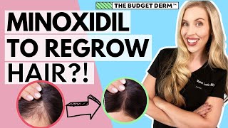 Minoxidil For Hair Loss  Everything you need to know [upl. by Keri]