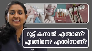 റൂട്ട് കനാൽ എന്താണ് എങ്ങിനെ എന്തിനാണ്  Root Canal Treatment what how why  Dr Anisha P John [upl. by Oglesby]