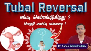 Tubal Ligation Reversal Procedure Success Rates  Tubal Ligation Reversal எப்படி செய்யப்படுகிறது [upl. by Jolie]