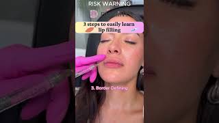 How to fill lips better Three steps to easily learn lip filling mesotherapy lipfiller filler [upl. by Allegna293]