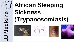 African Sleeping Sickness Trypanosomiasis  Causes Symptoms and Treatment [upl. by Westfall]