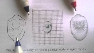 Maxillary left second premolar  occlusal aspect [upl. by Ecirtnas680]