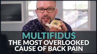 Multifidus The Most Overlooked Cause of Low Back Pain [upl. by Ner191]