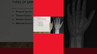 4️⃣ Types of epiphysis 🦴 anatomy anatomylectures osteology medicalstudent [upl. by Reinhard]