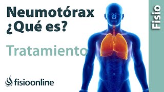 Neumotórax Qué es consejos y tratamiento a través de la fisioterapia respiratoria [upl. by Frerichs]