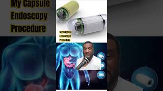 My Capsule Endoscopy Experience 2024 shorts [upl. by Ylrebma]