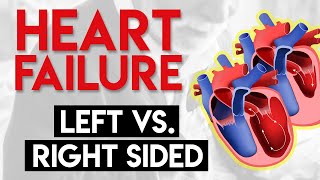 Left vs Right Heart Failure  Heart Failure Part 3 [upl. by Orozco9]