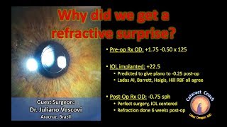 Why did we get a refractive surprise after Cataract Surgery [upl. by Edecrem182]