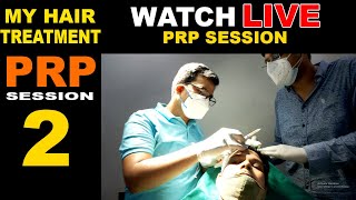 MY PRP SESSION2  HAIR TREATMENT  PRP  HAIRFALL [upl. by Minne]