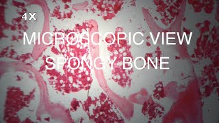 MICROSCOPIC VIEW  SPONGY BONE [upl. by Ngo950]