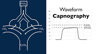 Waveform Capnography  BAVLS [upl. by Margarette]