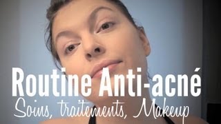 Acné  Traitements Soins amp Makeup HD 720p [upl. by Enimaj]