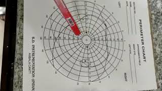 Perimetry 2 the perimeter chart [upl. by Nnauol658]