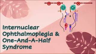 Internuclear Ophthalmoplegia amp One And A Half Syndrome [upl. by Netsud]