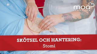 Skötsel och hantering  Stomi [upl. by Ellebana4]