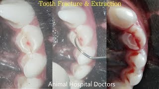 Tooth Fracture Tooth Extraction 치아골절 발치 [upl. by Niles]