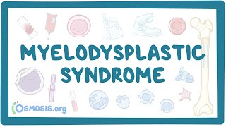 Myelodysplastic syndromes  causes symptoms diagnosis treatment pathology [upl. by Elroy149]