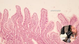 Microscopic anatomy of the small intestine [upl. by Adyahs]