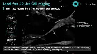 Karyoptosis cell deathLabel free live cell imaging by Holotomography [upl. by Attolrahc]