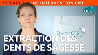 Extraction des dents de sagesse  Information patient ORL [upl. by Flory318]