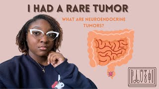 I Had a Rare Tumor Removed  Neuroendocrine Tumor Story [upl. by Faustus]