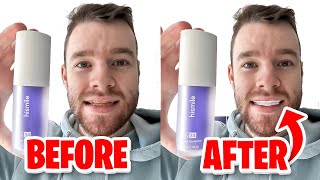 HiSmile v34 Colour Corrector  Get White Teeth Easy  Honest Review [upl. by Doss52]