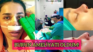 BURUN AMELİYATI SÜRECİM VLOG👃 AMELİYATHANE’DEN GÖRÜNTÜLER🩺💉 OpDrÖmerAmbarcıoğlu [upl. by Cloots]