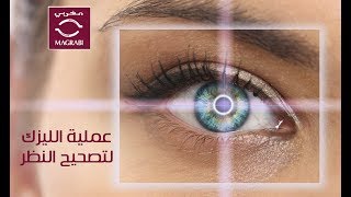 عملية الليزك لتصحيح النظر  مستشفيات مغربي [upl. by Viridis]