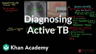 Diagnosing active TB  Infectious diseases  NCLEXRN  Khan Academy [upl. by Sidwohl]