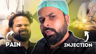 Side Effects of Hair Transplant  Anubhav Golia  Vlog [upl. by Krys]