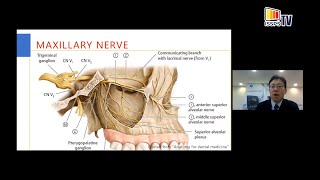 USG Maxillary amp Mandibular Nerve and Their Branches Block  The Lateral Pterygoid Plate Approach [upl. by Okihcim933]