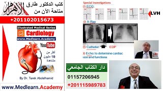 Heart Failure cme internalmedicine ecg usmle medical محاضراتباطنة [upl. by Rothberg109]