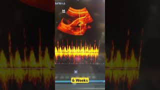 Fetal Heartbeat  6 weeks pregnancy ultrasound shorts [upl. by Moreen821]