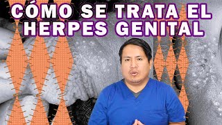 COMO ELIMINAR EL HERPES GENITAL [upl. by Nevile647]