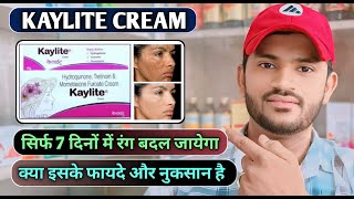 Kaylite cream how to usefull review in hindi जानिए कैलाइट क्रीम के फायदे और नुकसान [upl. by Vary]