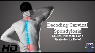 Cervical Spondylosis 101 Causes Symptoms and Treatment Insights [upl. by Sisto691]