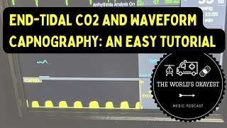 EndTidal CO2 and Waveform Capnography An Easy Tutorial Explicit [upl. by Carrillo]