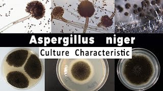 Aspergillus niger Culture Characteristic [upl. by Anirat]